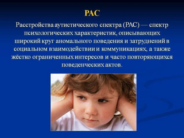 "Особенные" дети.